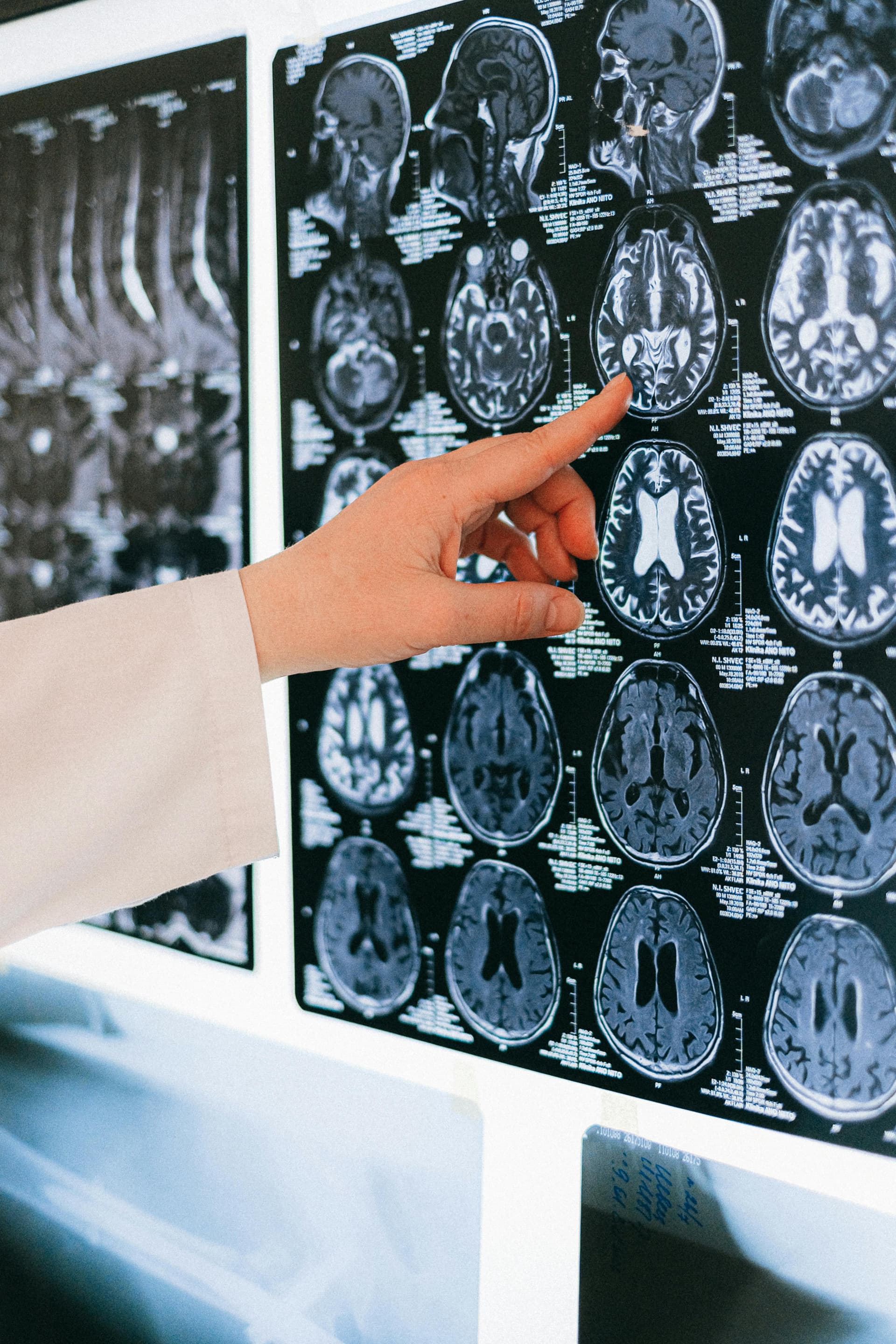 Safran & Cognition : Neuroprotection, Mémoire et Maladie d'Alzheimer